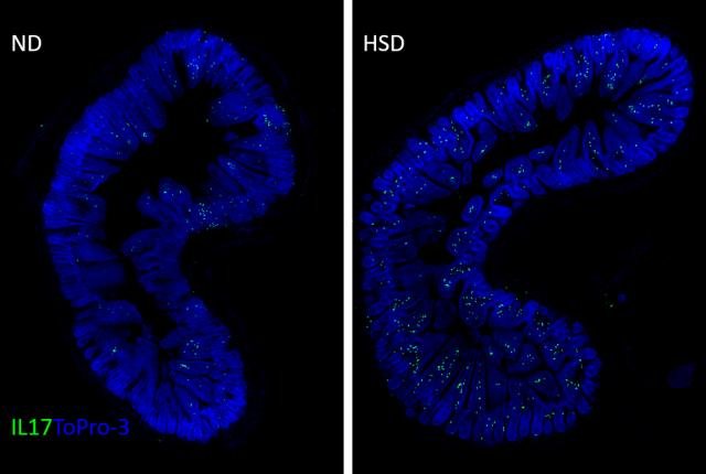 Salt Impacts Gut-Brain Connection