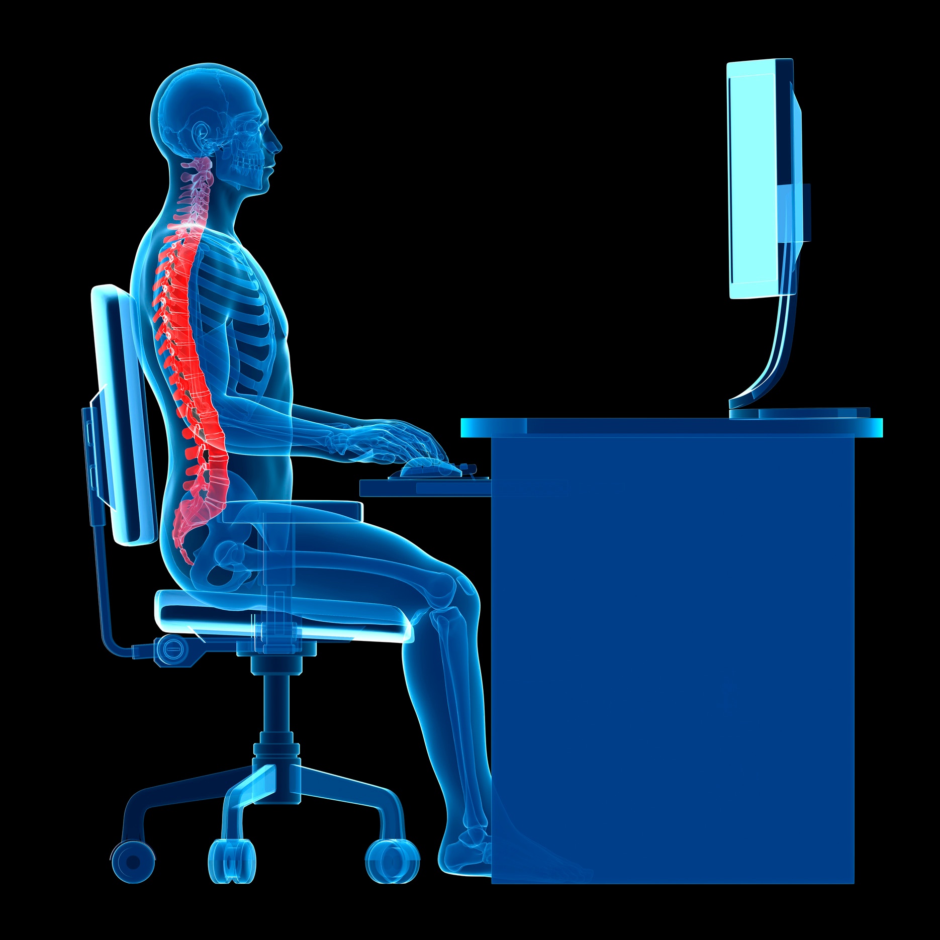 posture correction